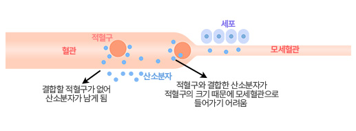기압환경 우리가 생활하는 기압 환경