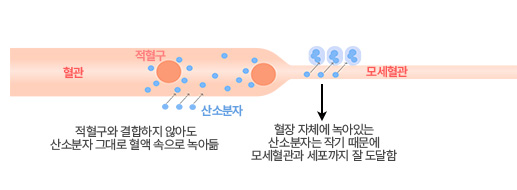 산소챔버 산소 챔버 고기압 환경