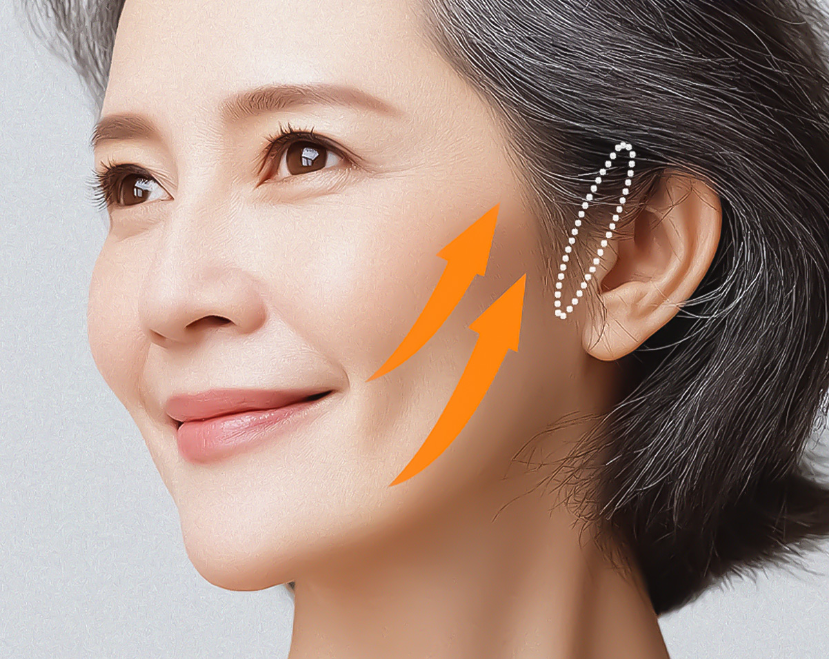 BB02 국소부위 절개로 필요한 범위만 최소 절개