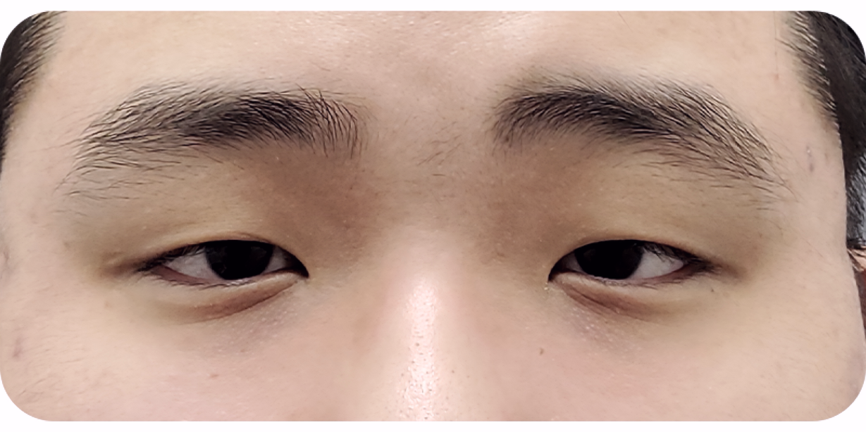 Before