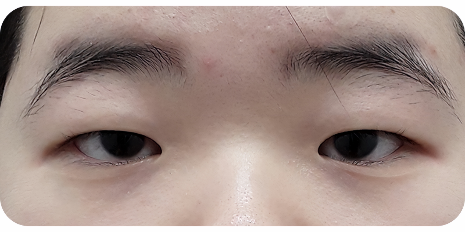 Before