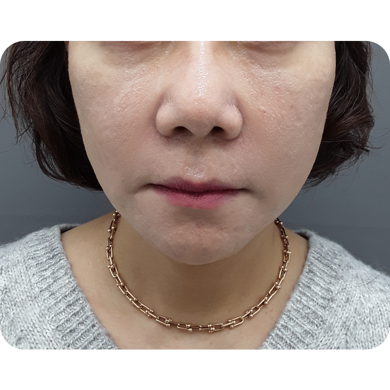After
