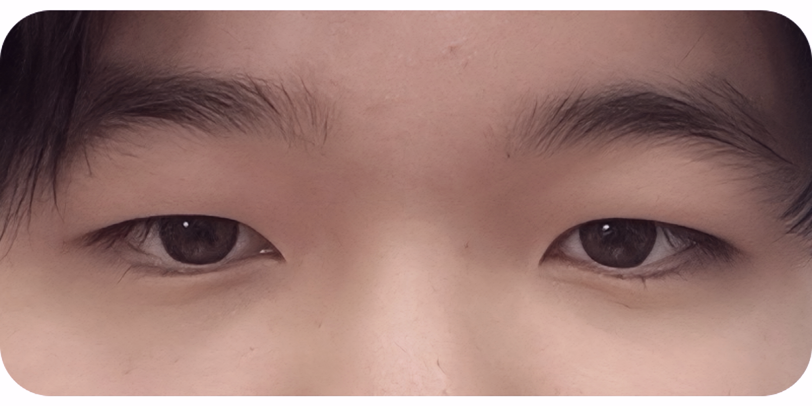 Before