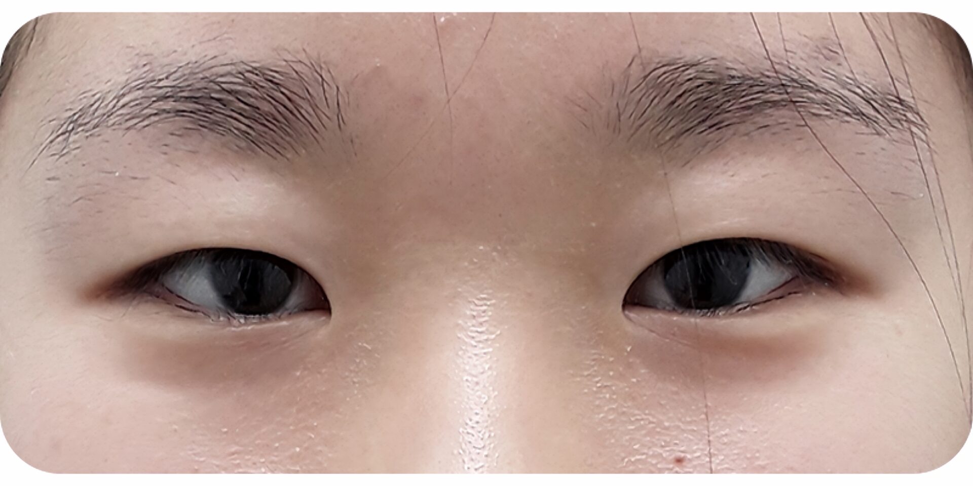 Before